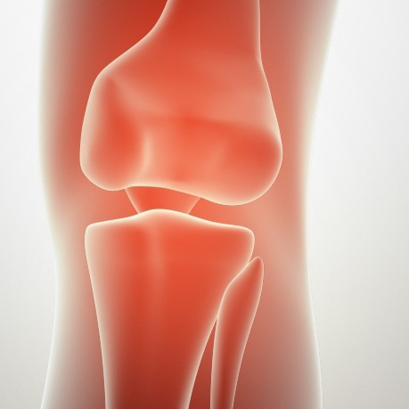 ACL Reconstruction Patellar Tendon