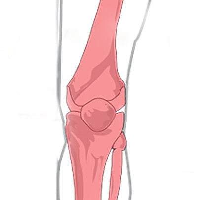 ACL Reconstruction