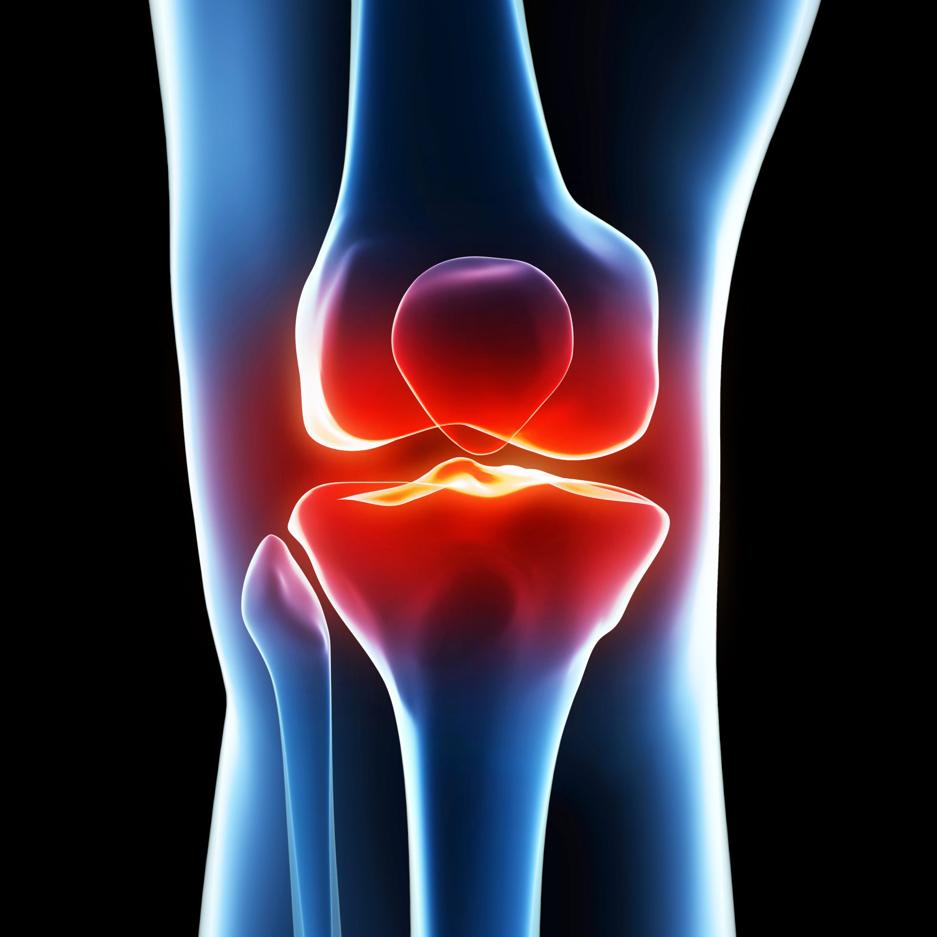 Arthroscopy of the Knee Joint