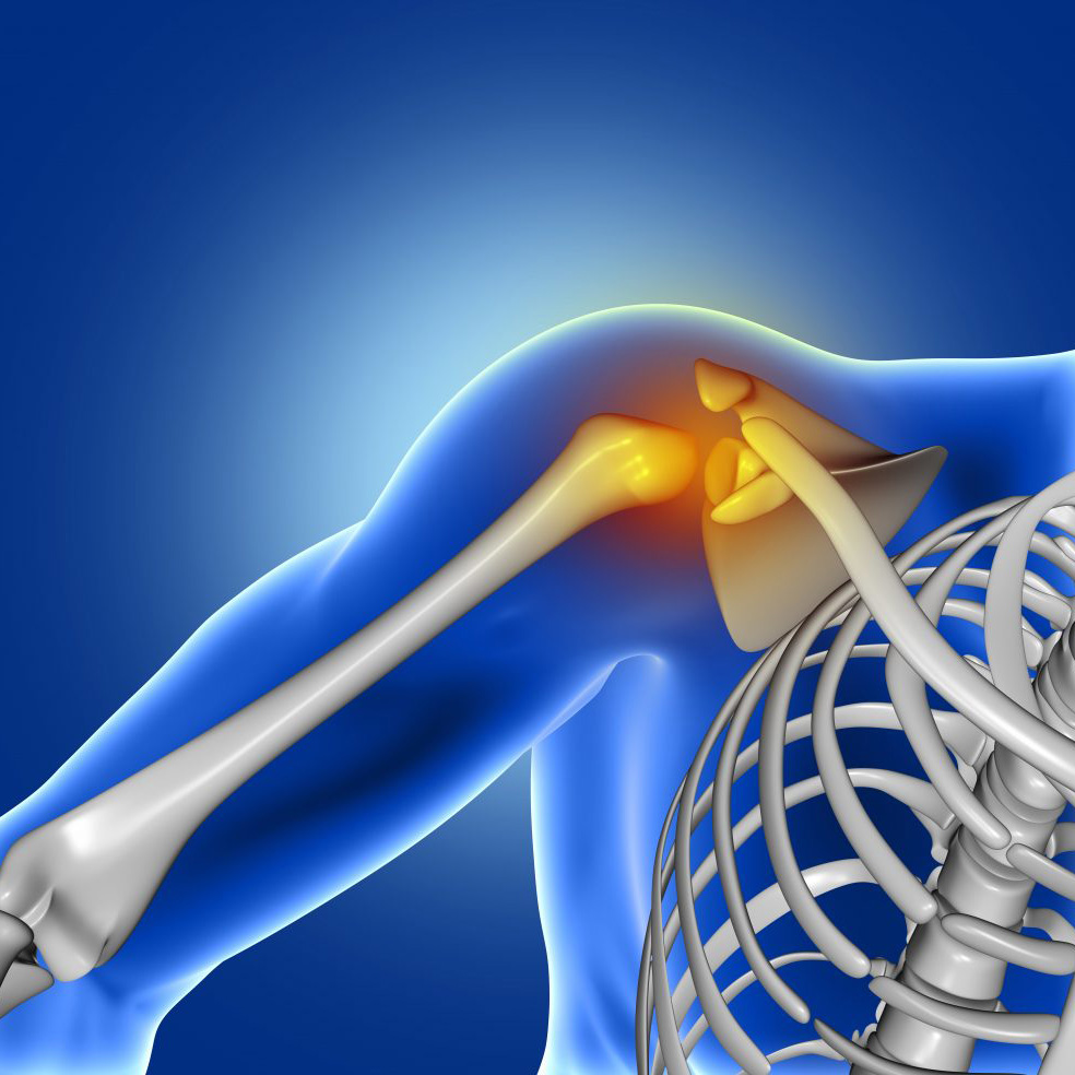 Shoulder Instability