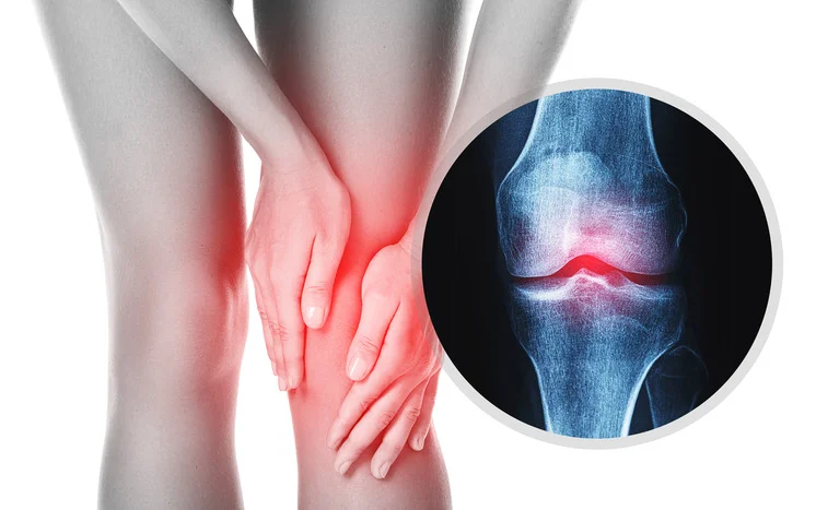 Multi-Ligament Knee Surgeries In Mohali, Chandigarh