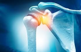 Comprehensive Insights into Shoulder Arthroscopy: Expertise by Dr. Vivek Bansal