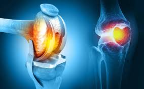 How to Find the Best Knee Replacement Surgeon in Chandigarh: A Complete Guide