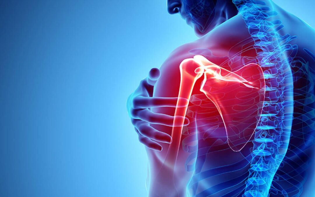 Shoulder Pain Specialists in Chandigarh: Expert Care for Quick Relief