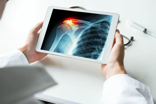 Find the Best Shoulder Injury Specialist Near Me in Chandigarh