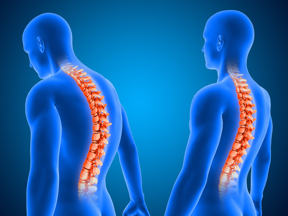 Top Treatments Offered by Back and Spine Specialists in Chandigarh