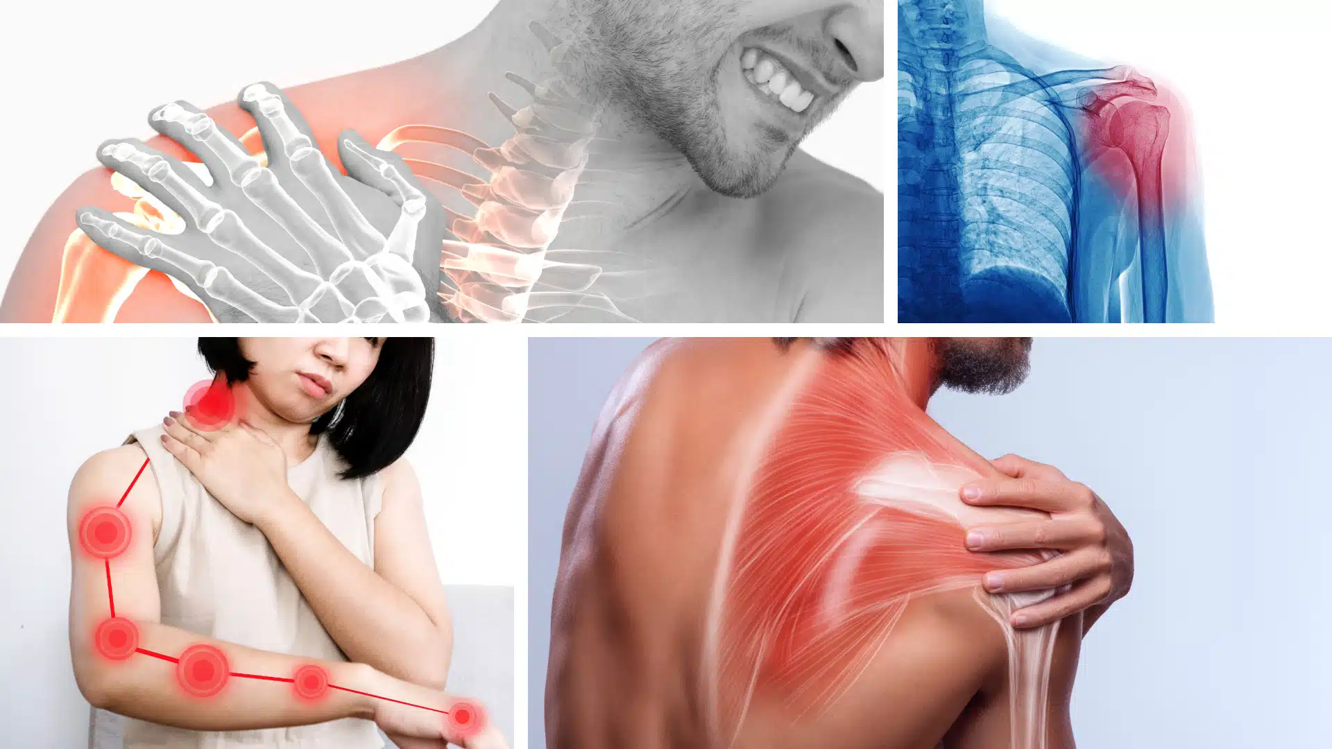 Expert Shoulder Pain Treatment by Leading Orthopedic Specialists in Chandigarh