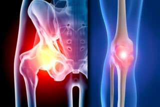 Expert Joint Replacement Specialists in Chandigarh for Hip and Knee Surgery Expert Joint Replacement Specialists in Chandigarh for Hip and Knee Surgery