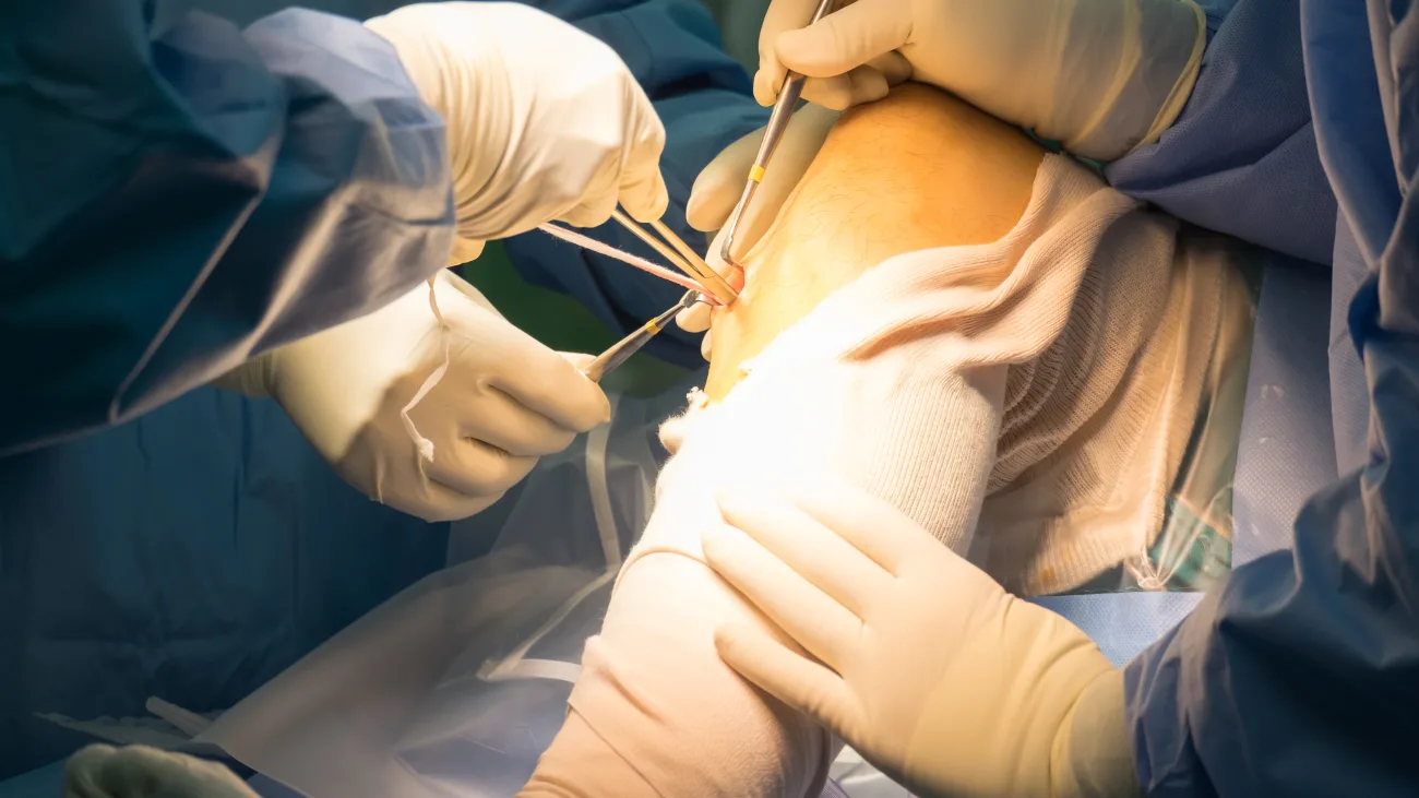 Experience Better Knee Recovery with the Top ACL Surgeon in Chandigarh