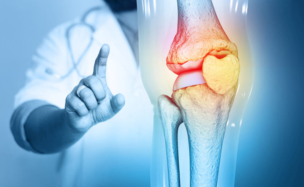 Top Bone Specialist in Chandigarh: Expert Care for All Your Orthopedic Needs Top Bone Specialist in Chandigarh: Expert Care for All Your Orthopedic Needs