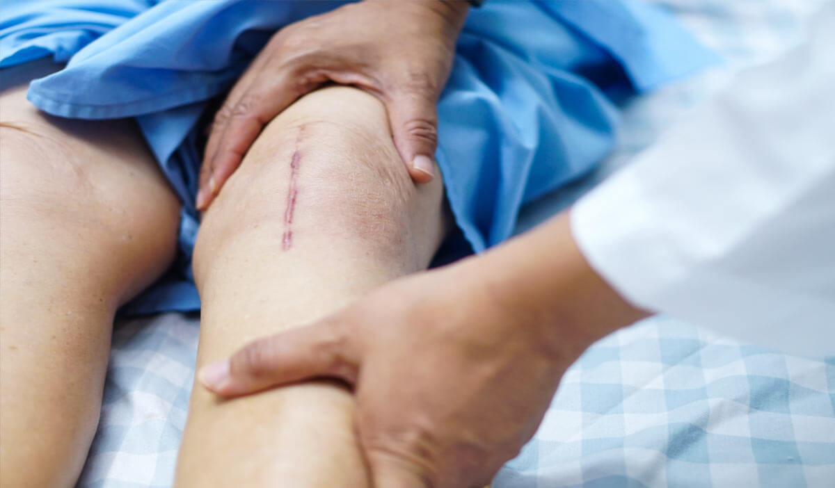Affordable and Advanced Knee Replacement in Chandigarh
