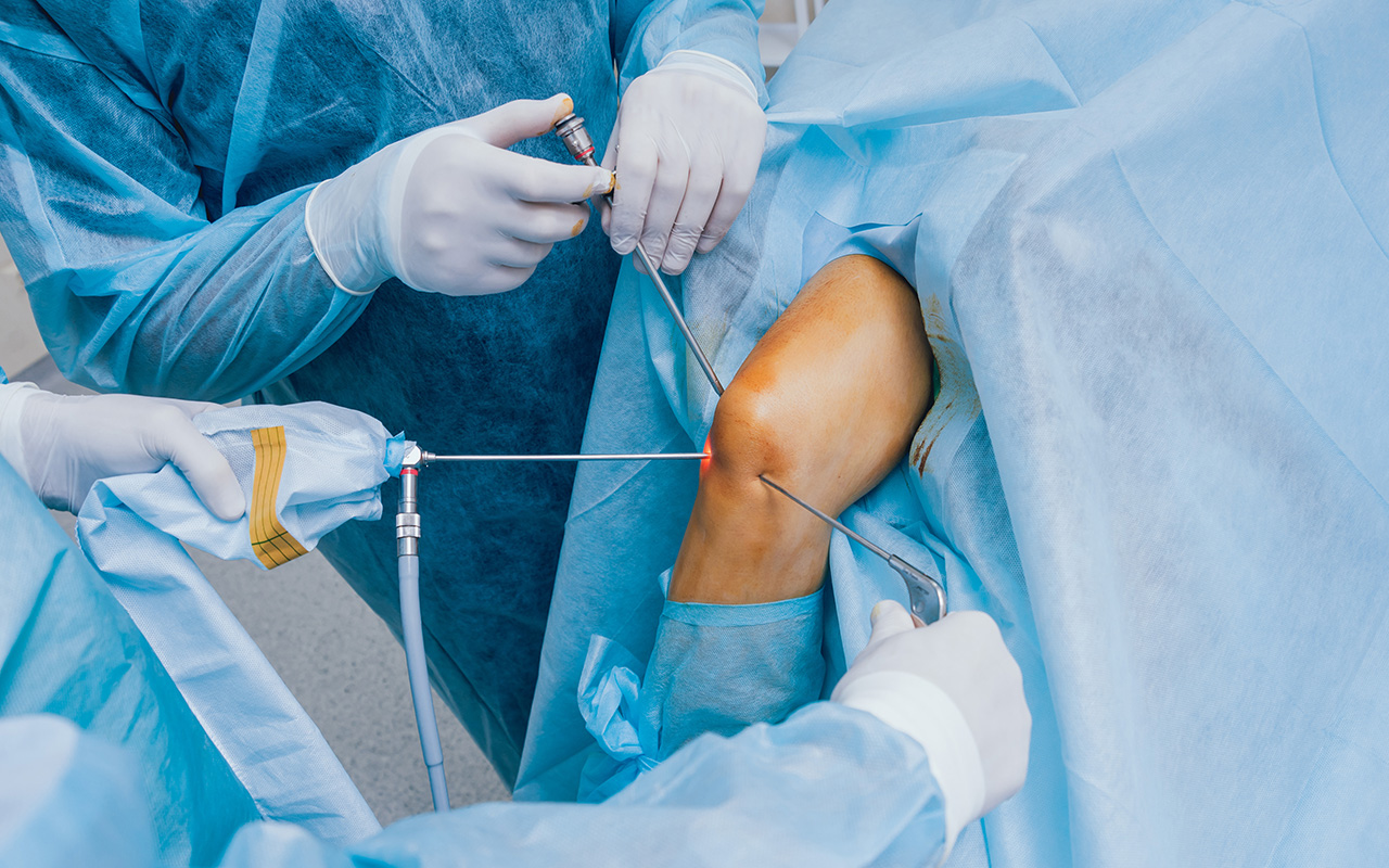 Knee Replacement Surgery by Expert Chandigarh Knee Surgeon Doctor
