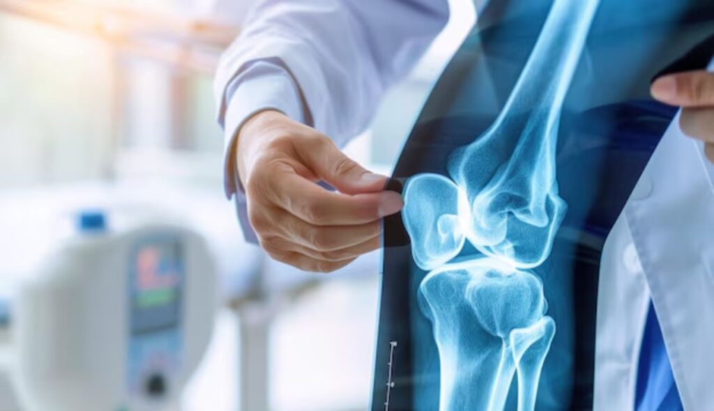 Expert Bone Specialist Chandigarh: Advanced Treatments for Fractures and Injuries