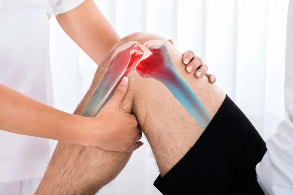 Best ACL Tear Injury Treatment in Chandigarh – Expert Knee Care You Can Trust