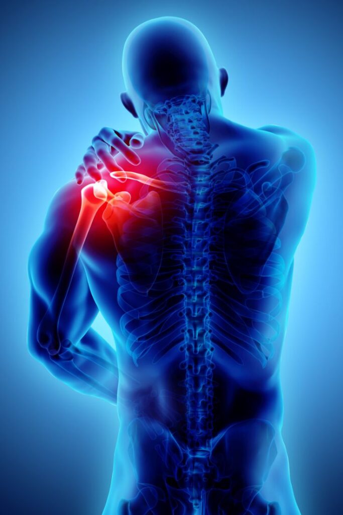 How Orthopedic Doctors Treat Frozen Shoulder. How Orthopedic Doctors Treat Frozen Shoulder.