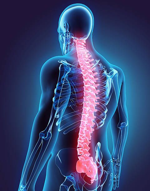 When Is Spine Surgery Necessary?