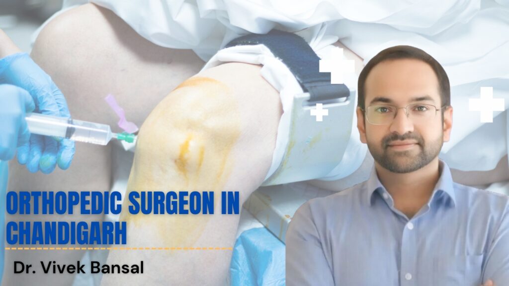 Orthopedic Surgeon in Chandigarh | Dr. Vivek Bansal