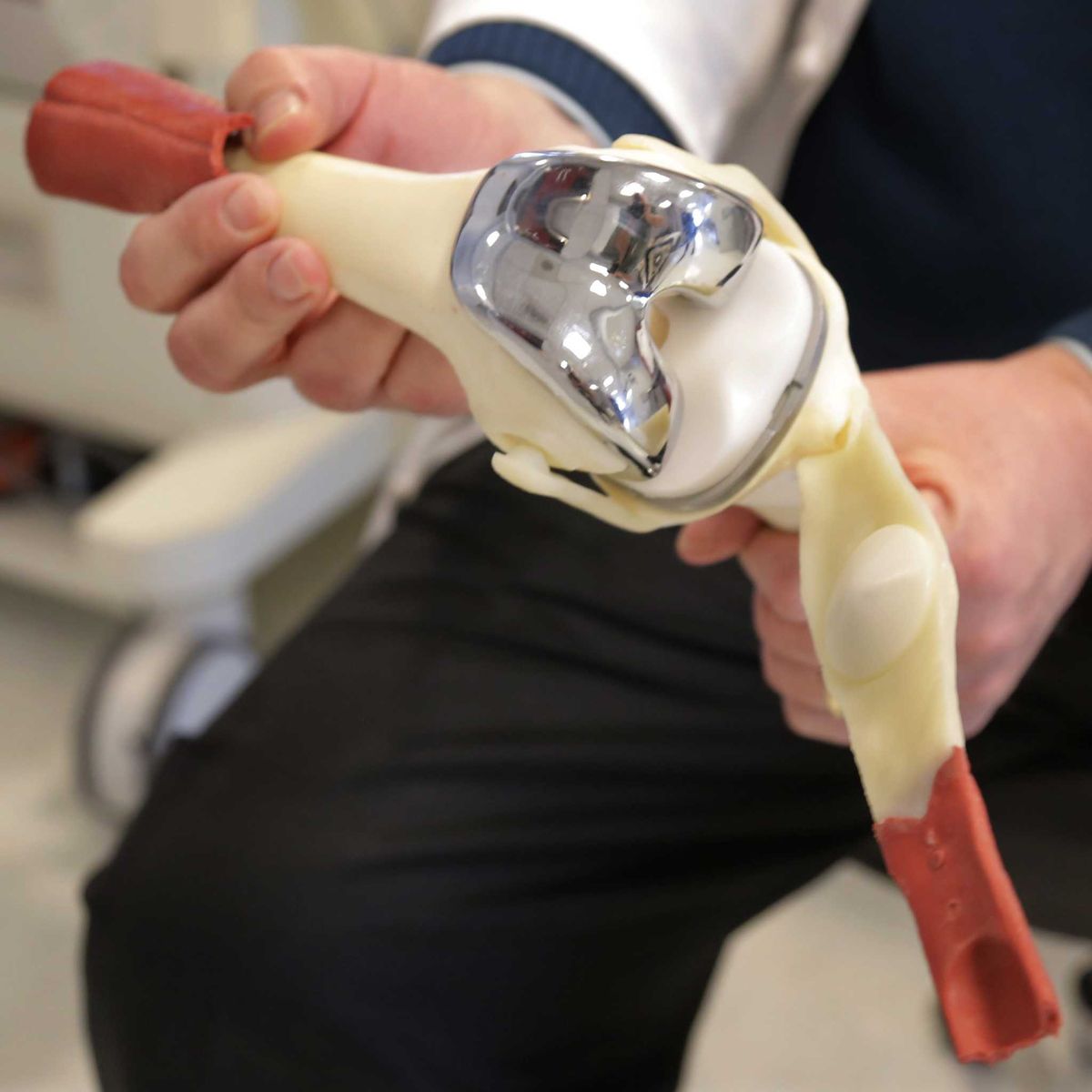 Partial Knee Resurfacing vs Total Knee Replacement: Which Is Right for You?