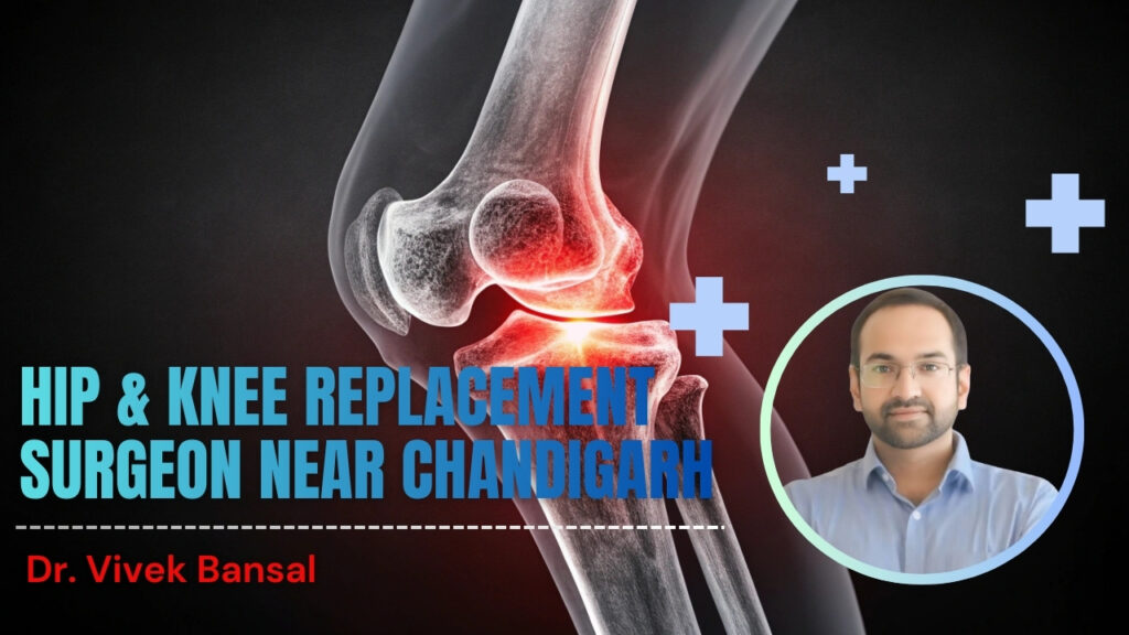 Hip & Knee Replacement Surgeon Near Chandigarh | Dr. Vivek Bansal