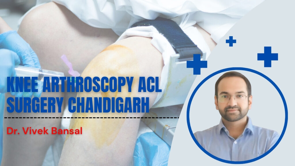 Knee Arthroscopy ACL Surgery Chandigarh | Dr. Vivek Bansal