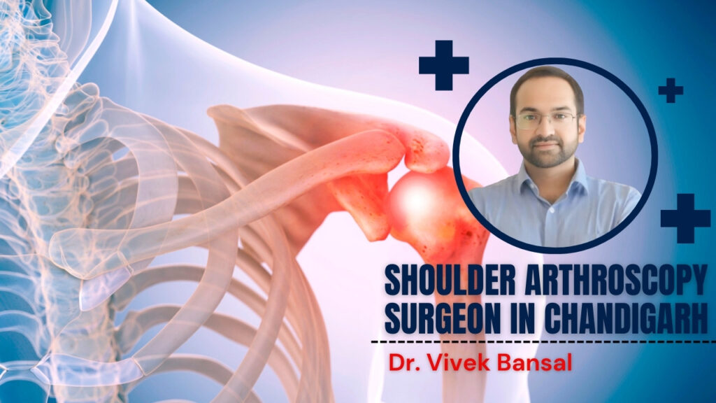 Shoulder Arthroscopy Surgeon in Chandigarh | Dr. Vivek Bansal