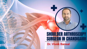 Shoulder Arthroscopy Surgeon in Chandigarh